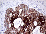 KRT8 Antibody in Immunohistochemistry (Paraffin) (IHC (P))