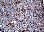 KRT8 Antibody in Immunohistochemistry (Paraffin) (IHC (P))