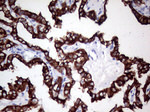 KRT8 Antibody in Immunohistochemistry (Paraffin) (IHC (P))