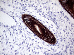 KRT8 Antibody in Immunohistochemistry (Paraffin) (IHC (P))