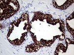 KRT8 Antibody in Immunohistochemistry (Paraffin) (IHC (P))