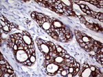 KRT8 Antibody in Immunohistochemistry (Paraffin) (IHC (P))