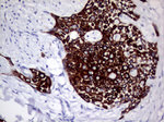 KRT8 Antibody in Immunohistochemistry (Paraffin) (IHC (P))