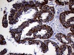 KRT8 Antibody in Immunohistochemistry (Paraffin) (IHC (P))