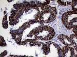 KRT8 Antibody in Immunohistochemistry (Paraffin) (IHC (P))