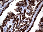 KRT8 Antibody in Immunohistochemistry (Paraffin) (IHC (P))