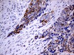 KRT8 Antibody in Immunohistochemistry (Paraffin) (IHC (P))