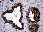 KRT8 Antibody in Immunohistochemistry (Paraffin) (IHC (P))