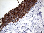 KRT8 Antibody in Immunohistochemistry (Paraffin) (IHC (P))