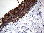 KRT8 Antibody in Immunohistochemistry (Paraffin) (IHC (P))