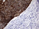 KRT8 Antibody in Immunohistochemistry (Paraffin) (IHC (P))