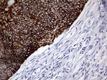 KRT8 Antibody in Immunohistochemistry (Paraffin) (IHC (P))