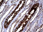 KRT8 Antibody in Immunohistochemistry (Paraffin) (IHC (P))