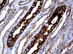 KRT8 Antibody in Immunohistochemistry (Paraffin) (IHC (P))