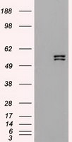 KRT8 Antibody in Western Blot (WB)