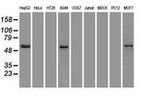 KRT8 Antibody in Western Blot (WB)