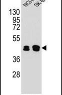 KRT80 Antibody in Western Blot (WB)