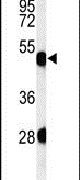 KRT82 Antibody in Western Blot (WB)