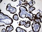 KRT84 Antibody in Immunohistochemistry (Paraffin) (IHC (P))