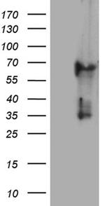 KRT84 Antibody in Western Blot (WB)