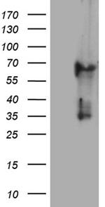 KRT84 Antibody in Western Blot (WB)