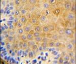 KRT9 Antibody in Immunohistochemistry (IHC)