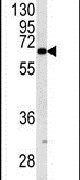 KRT9 Antibody in Western Blot (WB)