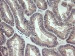 KRTAP2 Antibody in Immunohistochemistry (Paraffin) (IHC (P))