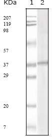 KSHV ORF62 Antibody in Western Blot (WB)