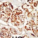 KSR1 Antibody in Immunohistochemistry (IHC)