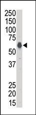 KSR1 Antibody in Western Blot (WB)