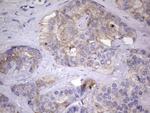 KYNU Antibody in Immunohistochemistry (Paraffin) (IHC (P))