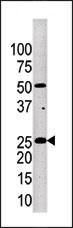 Kallikrein 4 Antibody in Western Blot (WB)