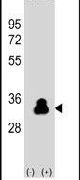 Kallikrein 4 Antibody in Western Blot (WB)