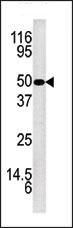 Kallikrein 5 Antibody in Western Blot (WB)