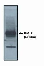 KV1.1 (KCNA1) Polyclonal Antibody