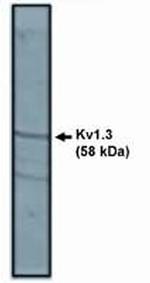KV1.3 (KCNA3) Polyclonal Antibody