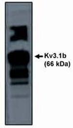 KV3.1 (KCNC1) Polyclonal Antibody