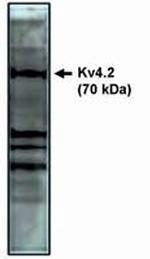 KV4.2 (KCND2) Polyclonal Antibody