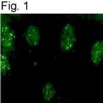 KChIP3 Antibody in Immunocytochemistry (ICC/IF)