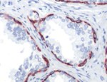 Cytokeratin 14 Monoclonal Antibody (SP53)