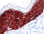 Cytokeratin 14 Antibody in Immunohistochemistry (IHC)