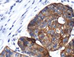 Cytokeratin 17 Antibody in Immunohistochemistry (IHC)