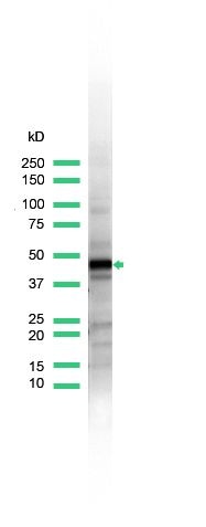 Cytokeratin 17 Antibody in Western Blot (WB)
