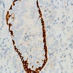Cytokeratin 6 Monoclonal Antibody (SP87)