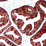 Cytokeratin 8 Antibody in Immunohistochemistry (IHC)