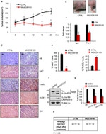 Ki-67 Antibody in Immunohistochemistry (Paraffin) (IHC (P))