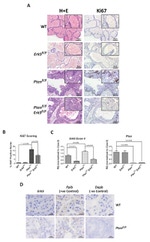 Ki-67 Antibody in Immunohistochemistry (IHC)