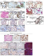 Ki-67 Antibody in Immunohistochemistry (IHC)