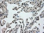 Ki67 Antibody in Immunohistochemistry (Paraffin) (IHC (P))